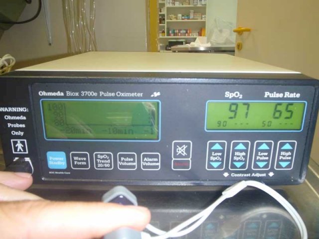 PULSOKSIMETAR OHMEDA 3700e