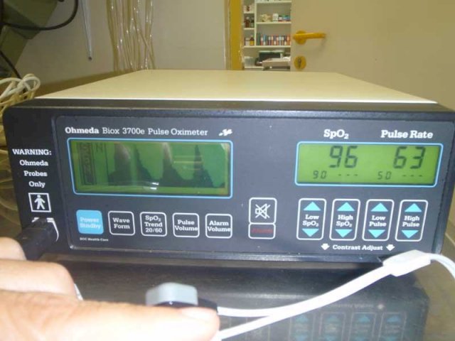 PULSOKSIMETAR OHMEDA 3700e